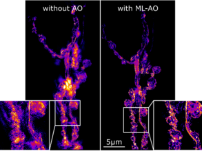 machine learning embedded adaptive optics